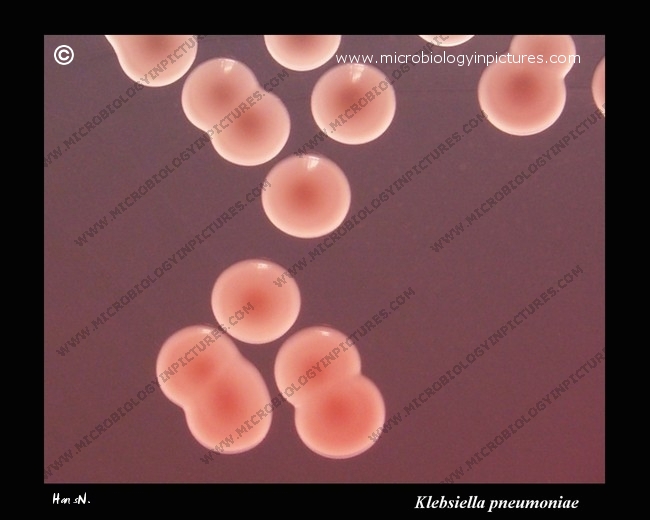 Klebsiella pneumoniae